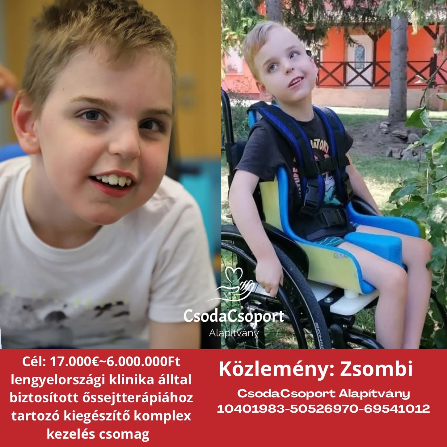 Zsombi